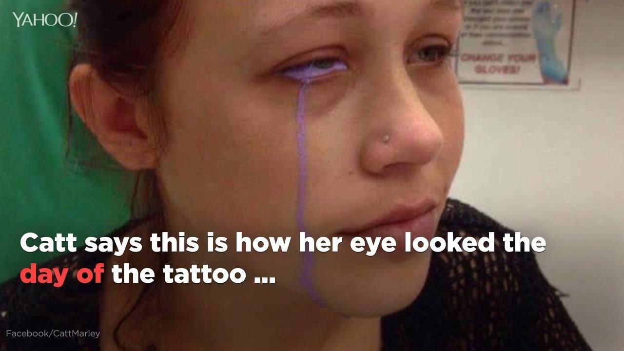 190K views · 272 reactions | A Canadian model is warning about the dangers of eye tattoos after one left her partially blind: http://bit.ly/2yyBpbt

(WARNING: Video contains disturbing images) | Yahoo Canada