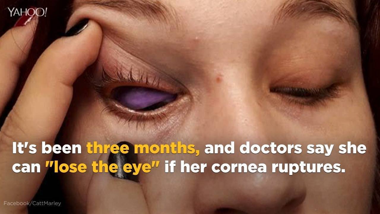 25K views · 66 reactions | #ICYMI: Ontario reportedly wants to ban eye tattoos and implantations of eye jewellery after a woman was left in danger of losing her eye earlier this year: http://bit.ly/2AnUJKr | Yahoo Canada