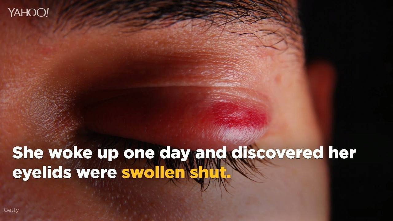 126K views · 196 reactions | Here's why you should always wash your bedsheets regularly: A woman reportedly had over 100 dust mites living in her eyelashes after not washing her pillowcase in five years (!): http://bit.ly/2oYq9oN | Yahoo Canada